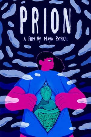 Prion