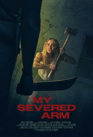 My Severed Arm
