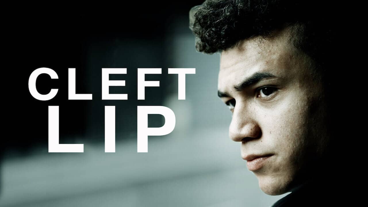 Cleft Lip backdrop