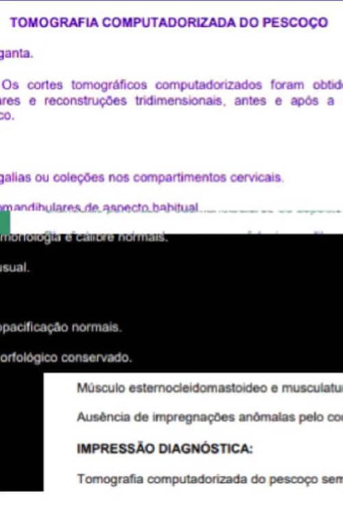 Uma tomografia do meu pescoço
